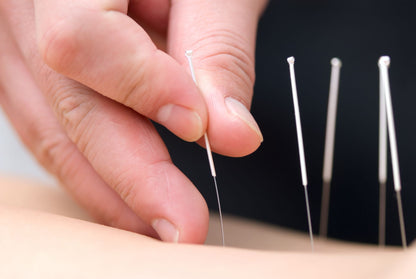 AcuPro naald - 0,30 x 75 mm - Dry Needling - Acupunctuur